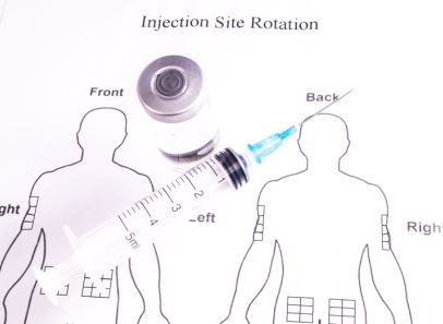 Insulin Injection Rotation Sites Chart