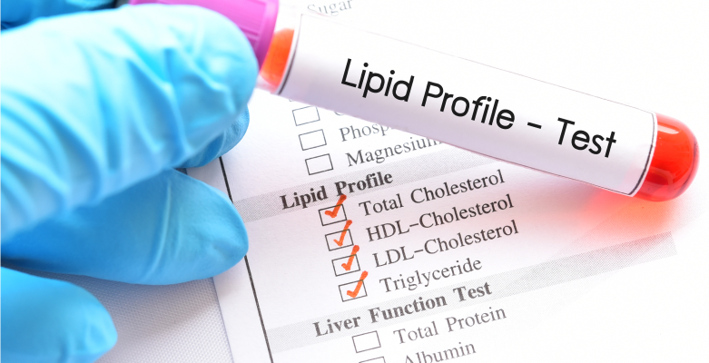 How Long To Fast For A Lipid Blood Test